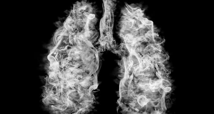 EVALI: síndrome respiratória aguda associada ao cigarro eletrônico