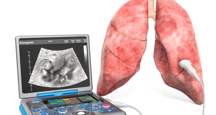 Ultrasonografia pulmonar em pediatria: menos radiação em nossas crianças?