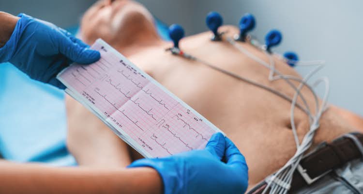 Quais achados eletrocardiográficos são preditores de deterioração clínica na embolia pulmonar?